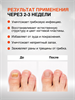 Противогрибковое средство Clopirox "Клопирокс" 15мл (Таиланд) 00-00031082 - фото 9184